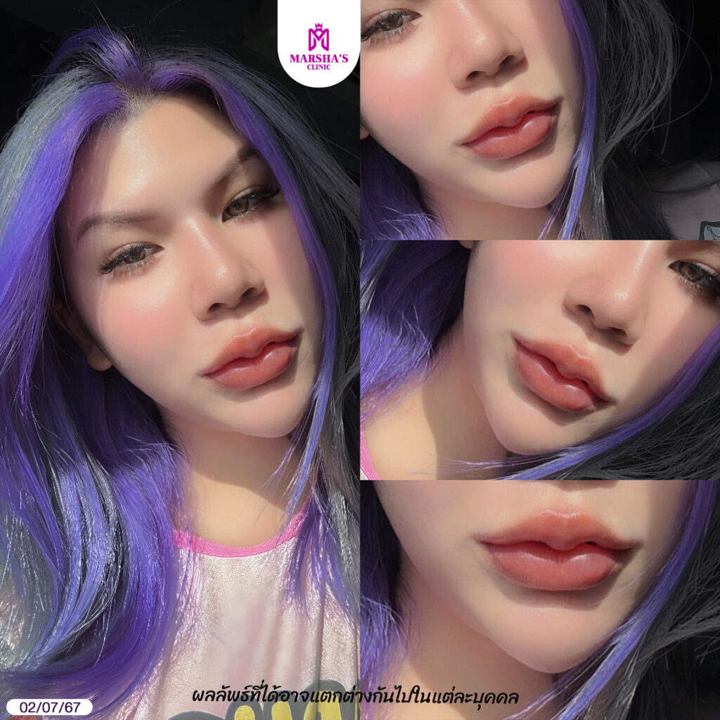63