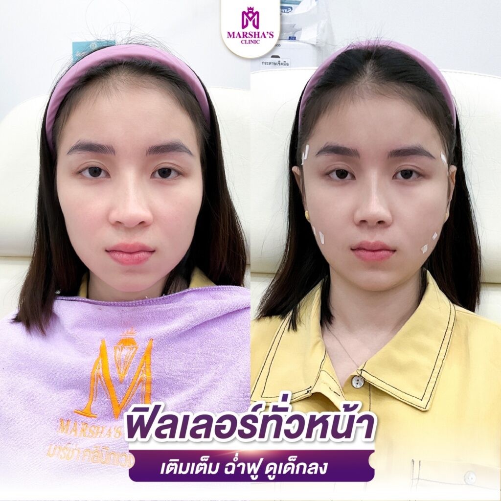 LINE_ALBUM_R ทั่วหน้า_๒๔๐๓๑๙_10