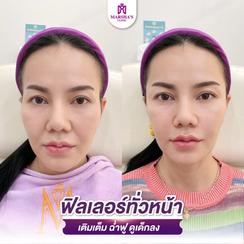 LINE_ALBUM_R ทั่วหน้า_๒๔๐๓๑๙_11