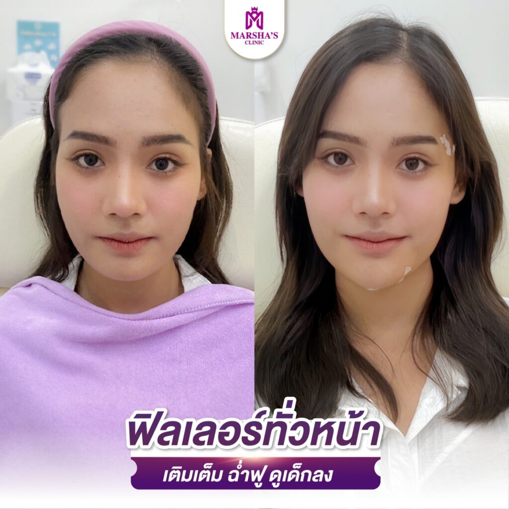 LINE_ALBUM_R ทั่วหน้า_๒๔๐๓๑๙_17