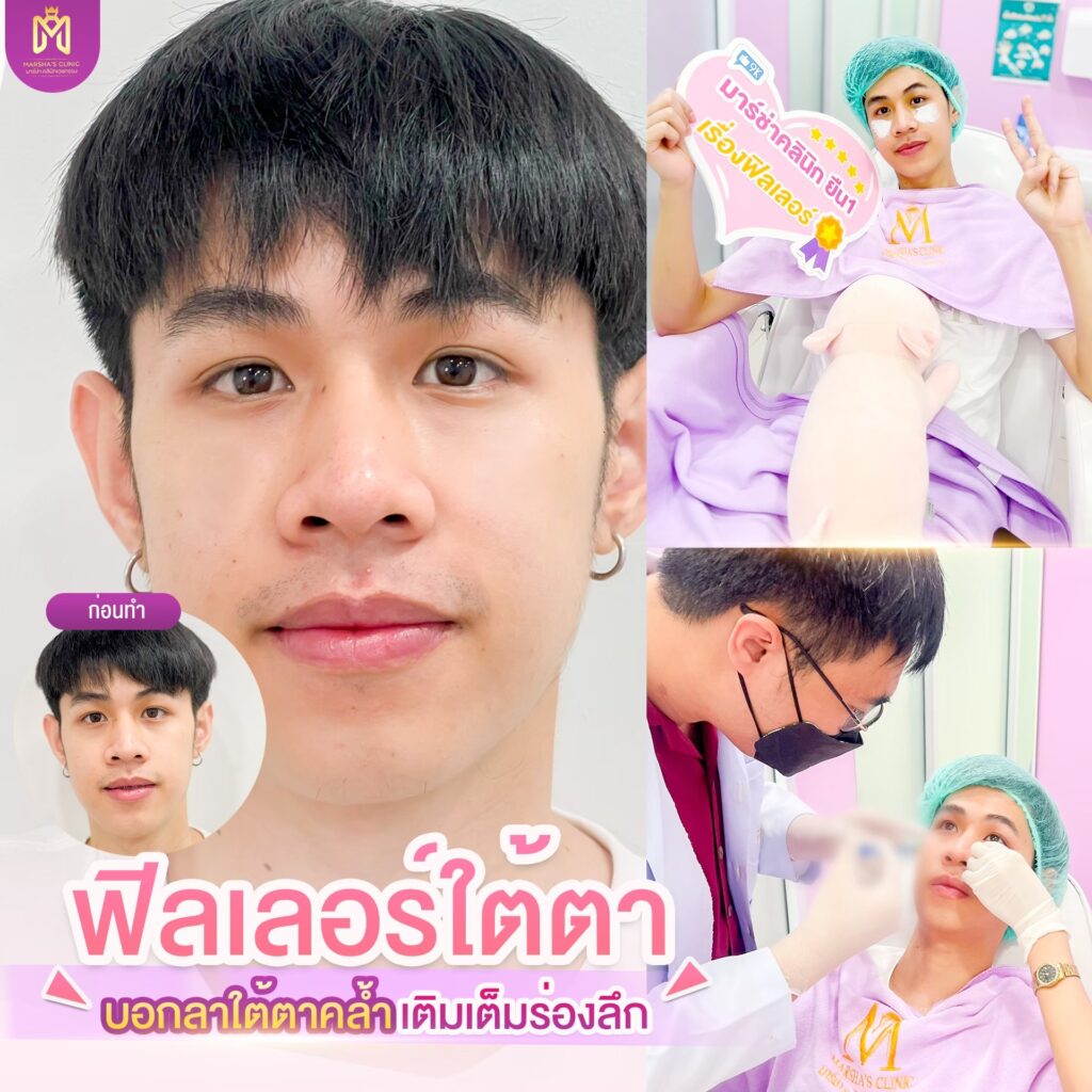 LINE_ALBUM_artwork new_๒๔๐๑๒๑_258